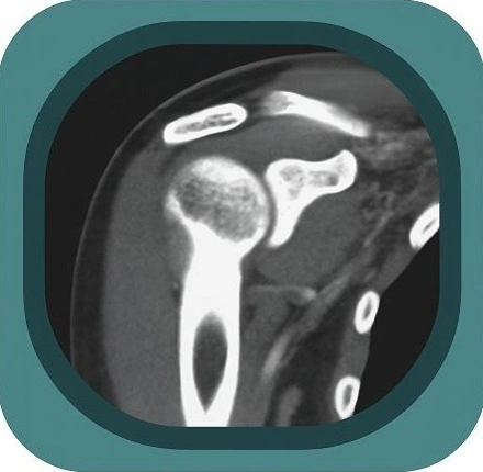 CT shoulder anatomy icon